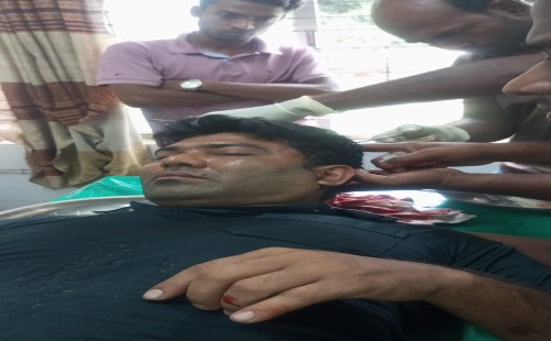 দামুড়হুদার সুবুলপুরে জমি নিয়ে বিরোধে একজনকে কুপিয়ে জখম