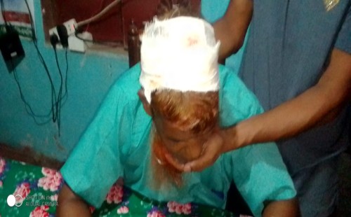 জামাইকে মারধরের খবর শুনে স্ট্রোকে শাশুড়ির মৃত্যু