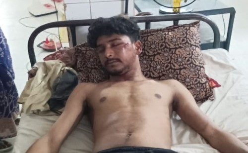 চুয়াডাঙ্গায় টাকা চাওয়া নিয়ে দ্বন্দ্ব, রাজমিস্ত্রির হেলপার জখম
