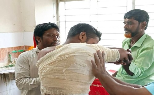 দামুড়হুদার লোকনাথপুরে একজনকে কুপিয়ে রক্তাত্ব জখম