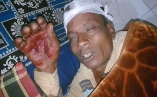 মুজিবনগরে ‘দাঁড়িপাল্লায়’ ভোট দেয়ায় দুজনকে পিটিয়ে জখম