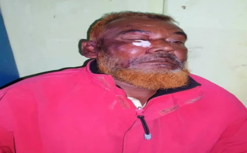 আলমডাঙ্গার বেলগাছীতে ছেলের হামলায় বাবা আহত