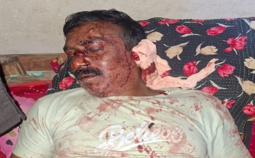 কুতুবপুরে স্বেচ্ছাসেবক দল নেতার বাড়িতে হামলা