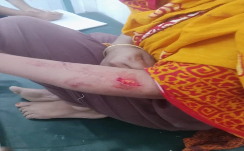 জীবননগরের রায়পুরে স্বেচ্ছাসেবক দলের আহ্বায়কের স্ত্রীকে কুপিয়ে জখম, থানায় অভিযোগ