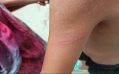 শিক্ষার্থী নির্যাতনের অভিযোগ, এলাকাবাসীর ক্ষোভ