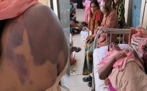 জীবননগরে জমি নিয়ে বিরোধে নারীকে পিটিয়ে জখম, গ্রেপ্তার বোন