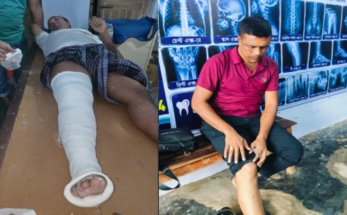 সংবাদ সংগ্রহে গিয়ে সড়ক দুর্ঘটনায় দুই সাংবাদিক আহত