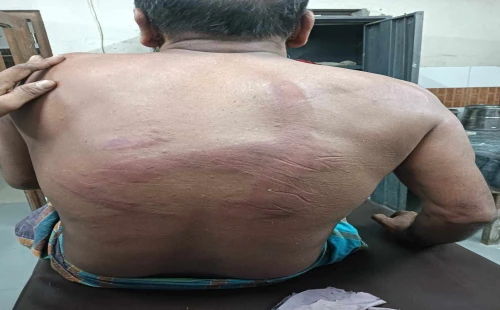 দর্শনায় চুরির প্রস্তাবে রাজি না হওয়ায় ব্যবসায়ীকে কুপিয়ে জখম