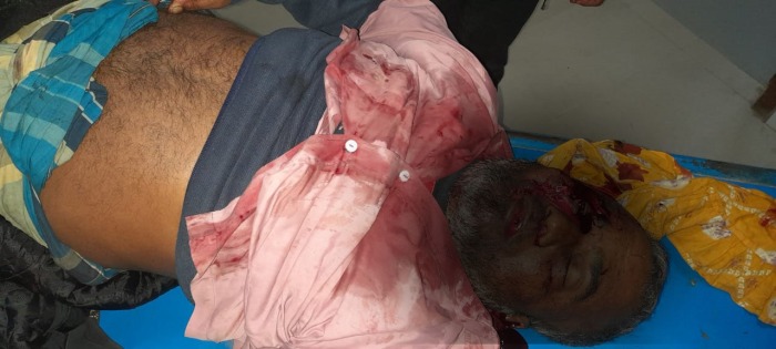 দুই মোটরসাইকেলের মুখোমুখি সংঘর্ষে প্রাণ গেল ব্যবসায়ী!