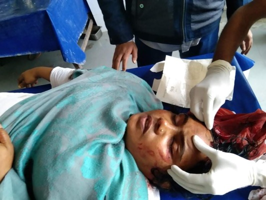 দ্বিতীয় স্ত্রীর বিরোধে প্রথম স্ত্রীকে কুপিয়ে জখম!