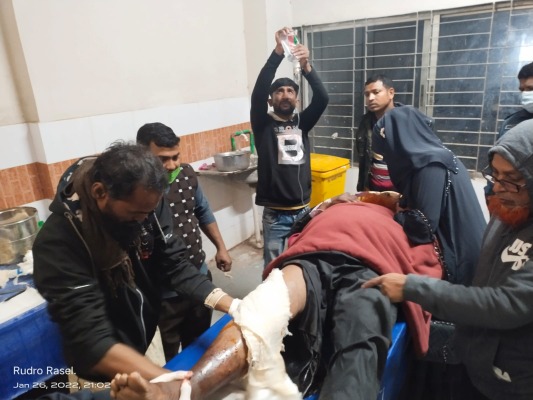 ছেলের মোটরসাইকেলে চড়ে পা হারালেন বাবা