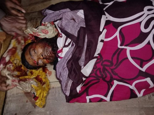 বিদ্যুৎস্পৃষ্টে স্ত্রীর মৃত্যুর ১০ দিন পর সড়ক দুর্ঘটনায় মারা গেলেন স্বামীও