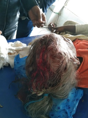 দায়ের কোপে নবতিপর বৃদ্ধাসহ দুজন জখম