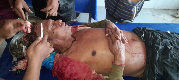 বড় ভাইকে হাতুড়িপেটা করল ছোট ভাই