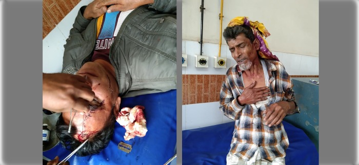 আলমডাঙ্গায় জমি নিয়ে সংঘর্ষে নারীসহ আহত চার