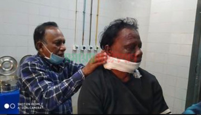 বাঁশের কঞ্চি কাটায় গলায় কোপ, অতপর ৫২ সেলাই!