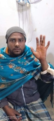 কার্পাসডাঙ্গায় তুচ্ছ ঘটনায় এক ব্যক্তিকে কুপিয়ে জখম