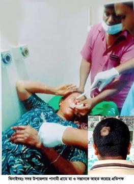 ধর্ষণে ব্যর্থ হয়ে নারীর নাক ফাটালেন লম্পট!