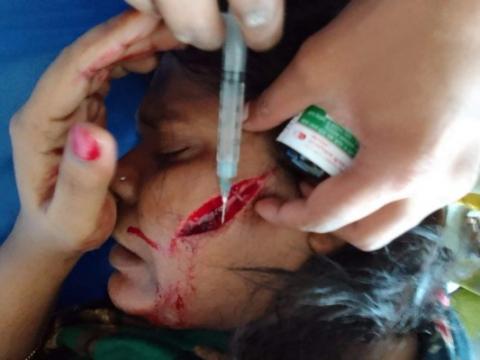 স্বামীর বটির কোপে স্ত্রী জখম!
