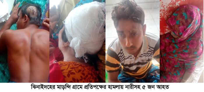 ঝিনাইদহে প্রতিপক্ষের হামলায় নারীসহ আহত ৫