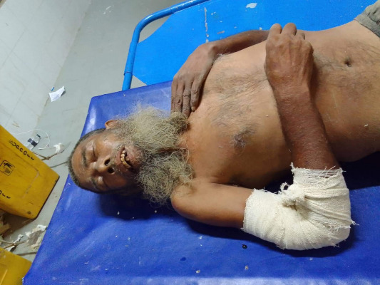চোর সন্দেহে বৃদ্ধকে নির্মম নির্যাতন!