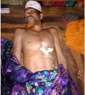 আলমডাঙ্গায় বজ্রপাতে কৃষকের মৃত্যু