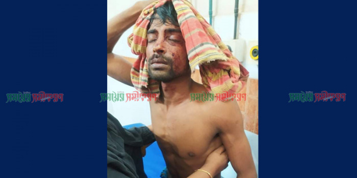 স্ত্রীকে কটূ কথা বলার প্রতিবাদ, স্বামীকে হাতুড়ি পেটা!