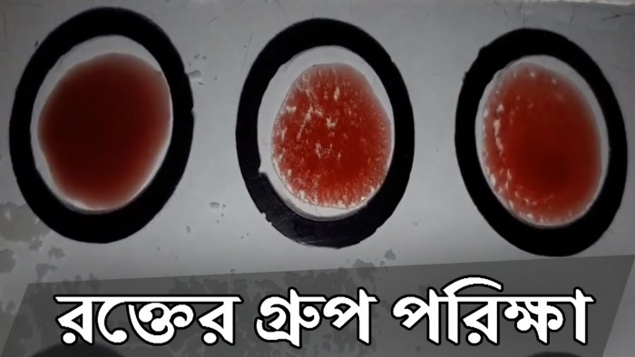 সারা বাংলা-৮৮ উদ্যোগে শিক্ষার্থীদের রক্তের গ্রুপ নির্ণয় কর্মসূচি