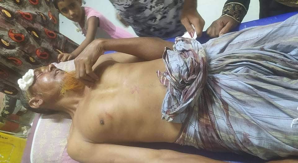 কার্পাসডাঙ্গার পীরপুরকুল্লায় বৃদ্ধকে পিটিয়ে জখম