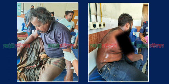 আলমডাঙ্গায় সড়ক দুর্ঘটনায় পুলিশ সদস্যসহ দুজন জখম