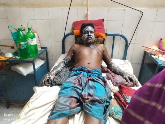 আলমডাঙ্গায় পুরাতন মবিল পরিশোধনের সময় শ্রমিক দদ্ধ