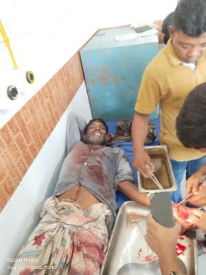 বেড়া নিয়ে বিরোধ, কৃষককে কুপিয়ে জখম!