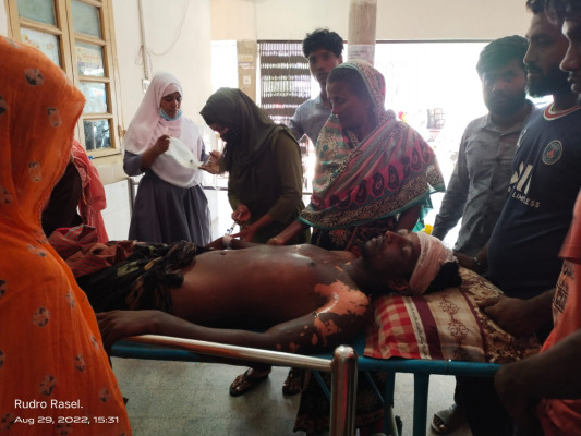 চুয়াডাঙ্গায় বিদ্যুৎস্পৃষ্ট হয়ে রডমিস্ত্রি দগ্ধ, রাজশাহী রেফার্ড