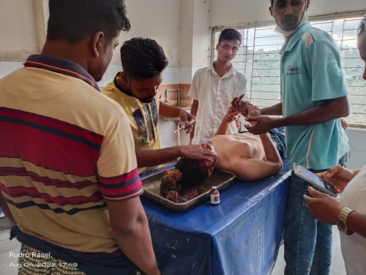 আলমডাঙ্গায় সড়ক দুর্ঘটনায় যুবক জখম, রেফার্ড