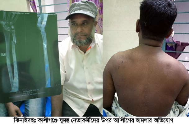 বিএনপির ঘুমন্ত নেতা-কর্মীদের ওপর আ.লীগের হামলা