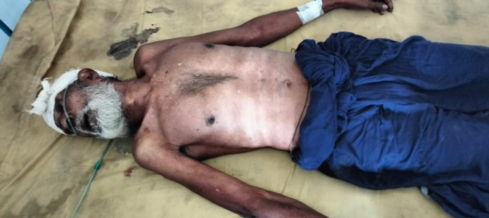 কুড়ুলগাছিতে মোটরসাইকেলের ধাক্কায় বৃদ্ধ নিহত