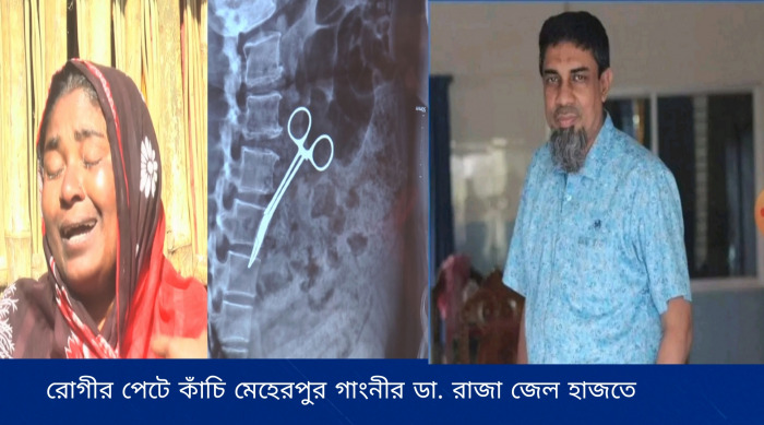 রোগীর পেটে কাঁচি রেখে সেলাই, চিকিৎসক কারাগারে