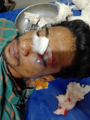 চুয়াডাঙ্গায় পূর্ব বিরোধের জেরে যুবককে ছুরিকাঘাত