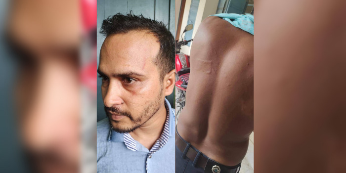 দুই শিক্ষককে পেটালেন প্রধান শিক্ষক