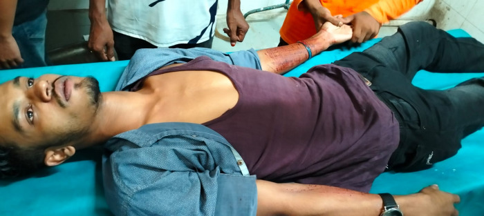 চুয়াডাঙ্গায় প্রেমে ছ্যাকা খেয়ে নিজের হাত ক্ষত-বিক্ষত করল যুবক