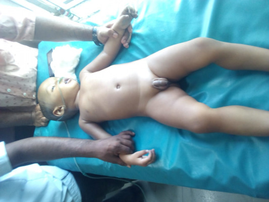 চিকিৎসক মৃত ঘোষণার পরেও নড়ে উঠল শিশু!