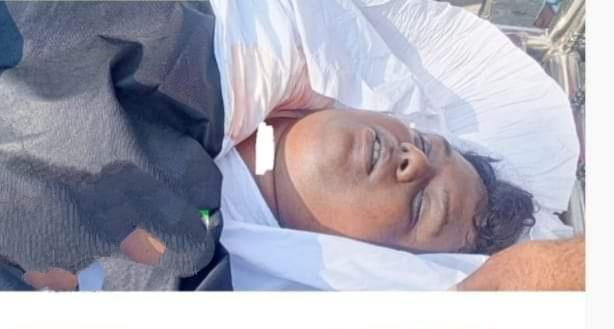 আলমডাঙ্গার ফাতেমা ক্লিনিকে দাঁতের চিকিৎসা করাতে গিয়ে বিপত্তি