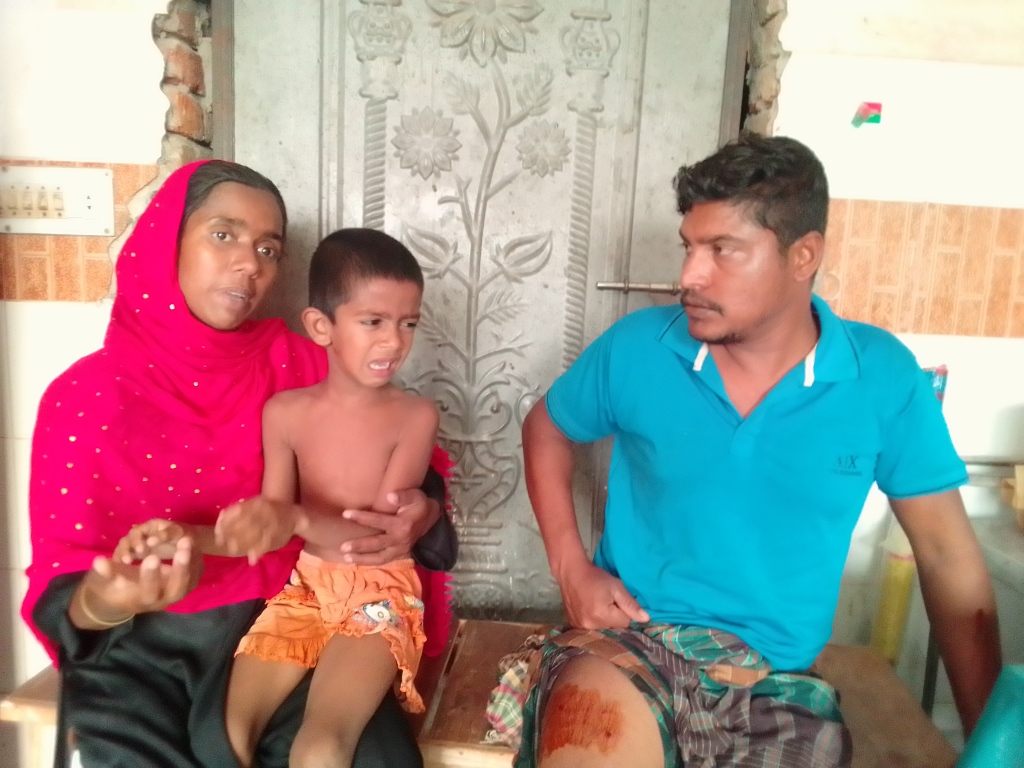 চুয়াডাঙ্গায় কুকুরের কামড়ে শিশুসহ দুজন জখম