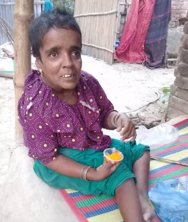 প্রতিবন্ধী ভাতায় চলে সংসার, চিকিৎসায় সহযোগিতার আহ্বান
