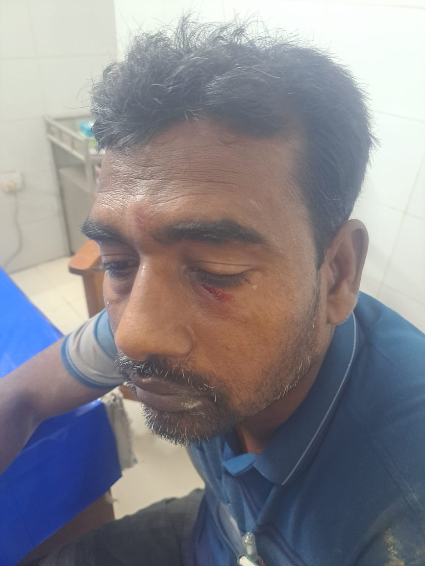 আলমডাঙ্গার আঠারোখাদায় ভাইকে হাতুড়িপেটা
