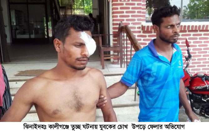 কালীগঞ্জে তুচ্ছ ঘটনায় যুবকের চোখ উপড়ে ফেলার অভিযোগ