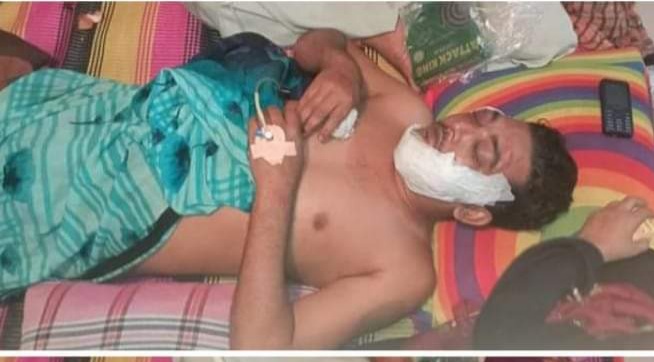আলমডাঙ্গায় সড়ক দুর্ঘটনায় ছাত্রলীগ নেতা জখম