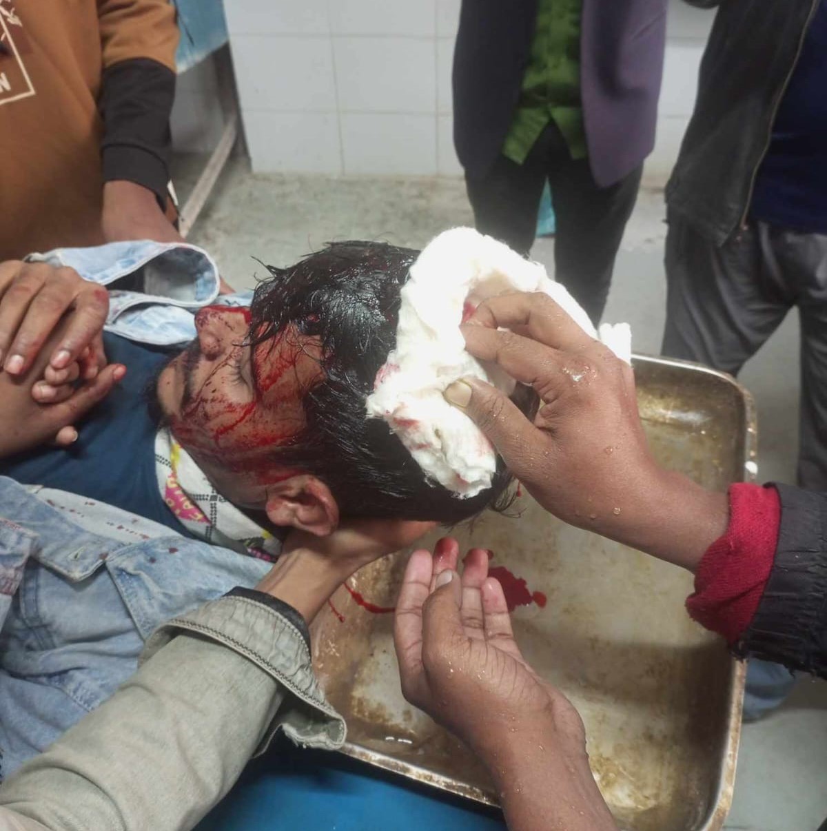 দামুড়হুদায় রসের ভাড় ভাঙা নিয়ে দ্বন্দ্বে যুবককে কুপিয়ে জখম