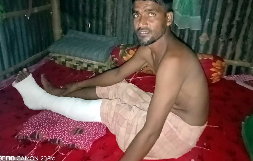 চুয়াডাঙ্গায় জামাইকে পিটিয়ে পা ভেঙে দিলেন শাশুড়ী