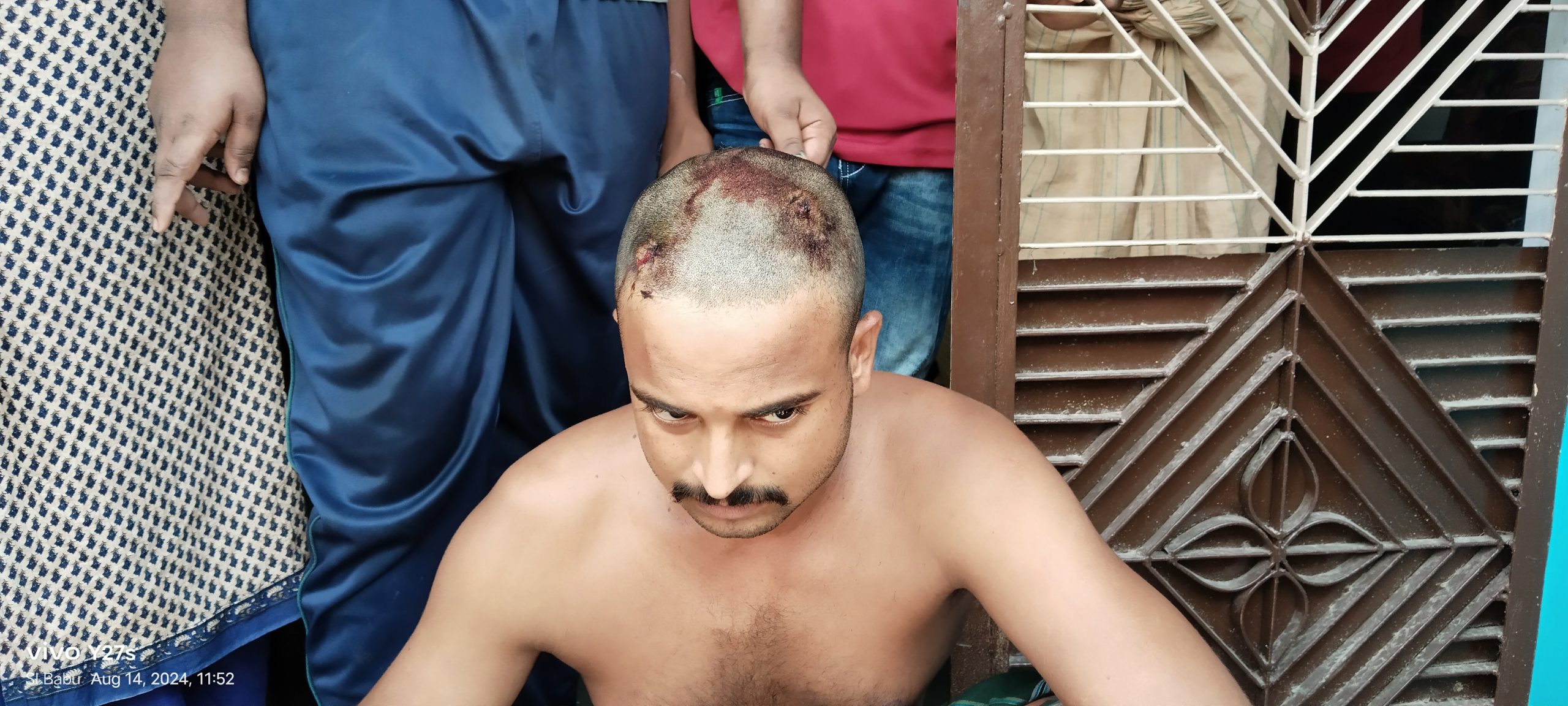 মেহেরপুরে যুবককে পিটিয়ে জখম